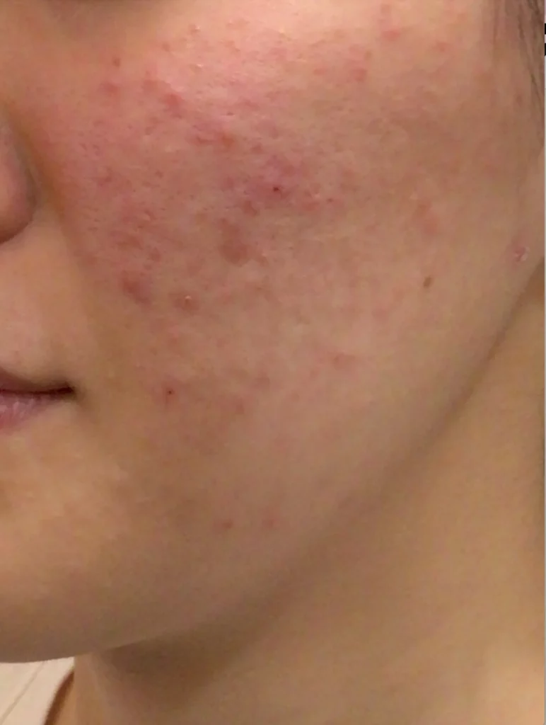 alcler medspa before & after