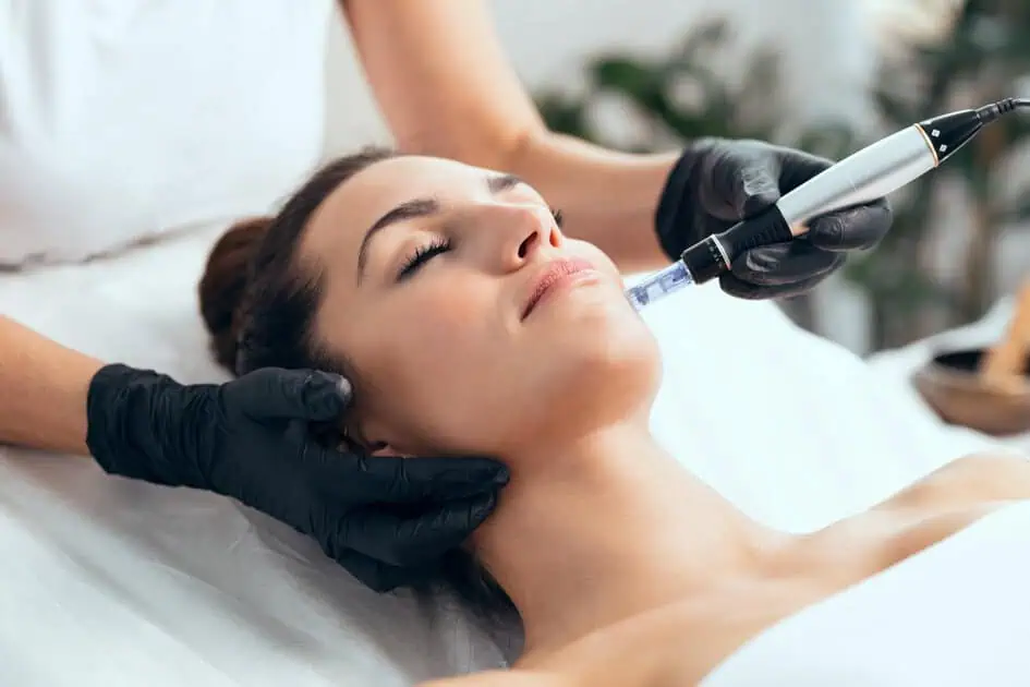 Needling Procedures in Brea, CA | Alcler Medspa