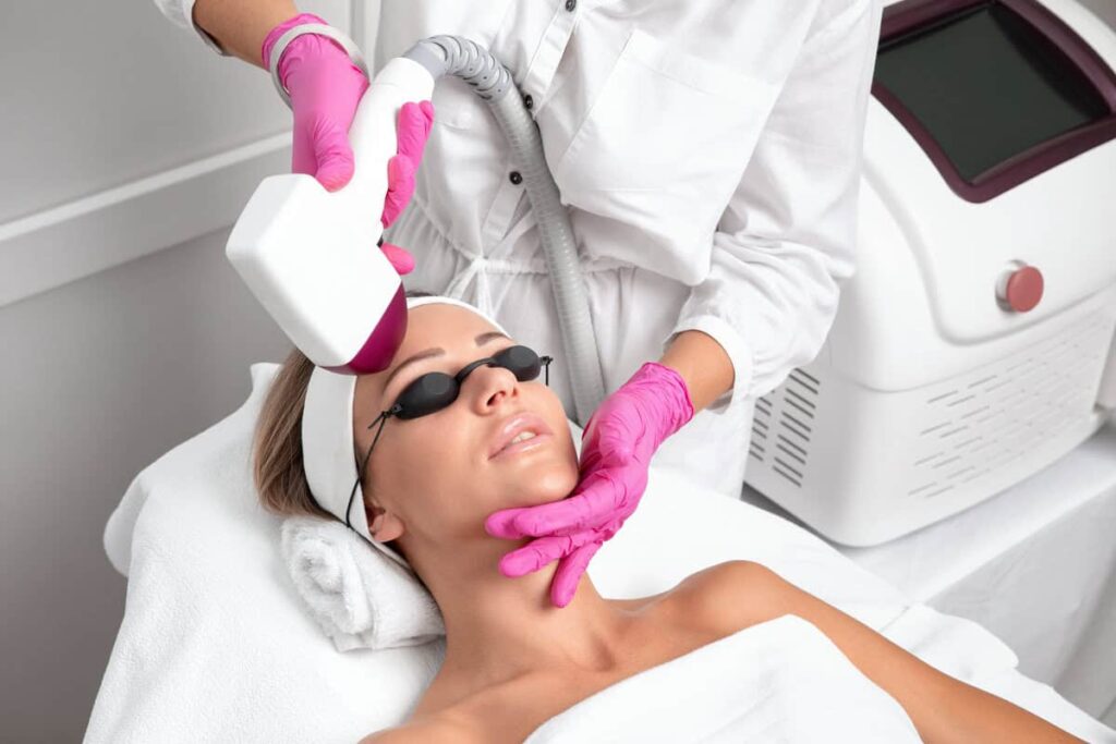 Laser Toning for Hyperpigmentation
