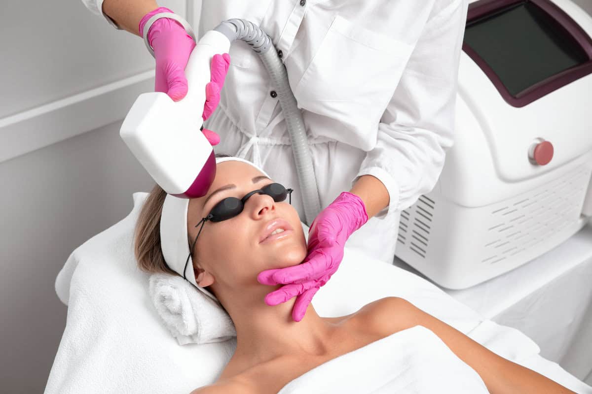 Laser Toning for Hyperpigmentation