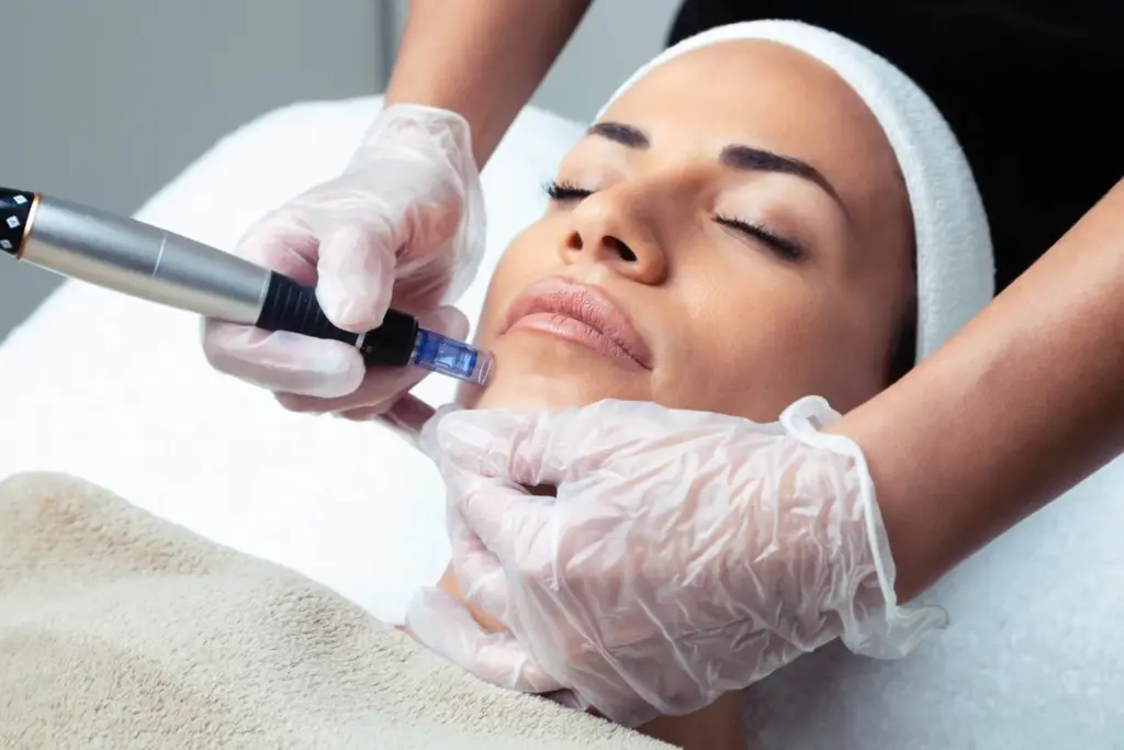 Close-up of a client wearing a headband receiving exosome therapy via specialized facial applicator