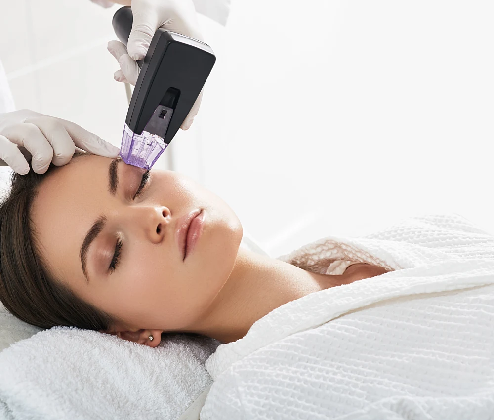 Practitioner applying a Morpheus8 RF microneedling handpiece to a client's cheek