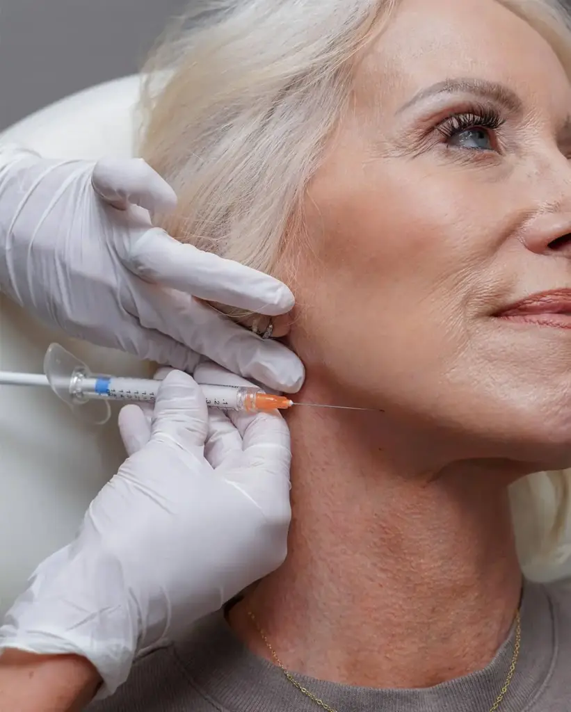 Close-up profile of a woman showcasing restored cheek and facial volume after Radiesse