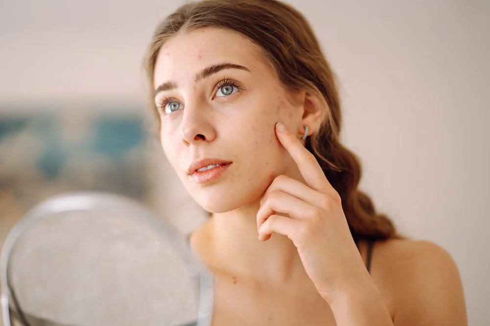 Portrait of a woman showcasing smooth under-eye and cheek skin post-treatment